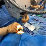 پیوند قرنیه در بیمارستان دکتر بسکی